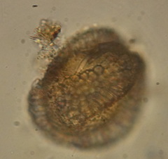 Rotifera
