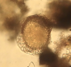 Rotifera
