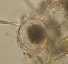 Rotifera