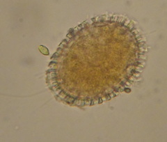 Rotifera