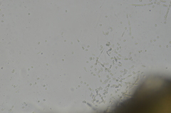Trichoderma pulvinatum