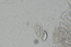 Trichoderma pulvinatum