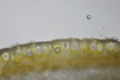 Trichoderma pulvinatum