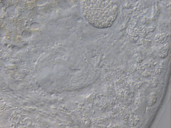 Macrostomum balticum