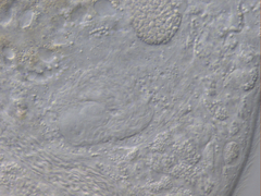 Macrostomum balticum
