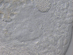 Macrostomum balticum