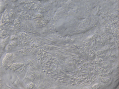 Macrostomum balticum