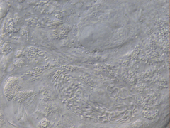 Macrostomum balticum