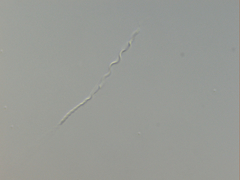 Macrostomum balticum