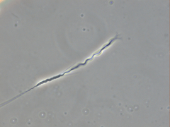 Macrostomum balticum