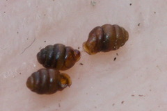 Vertigo angustior