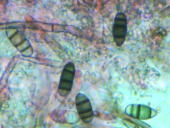 Brachysporium