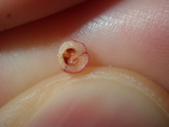 Austroacacidiplosis botrycephalae