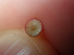 Austroacacidiplosis botrycephalae