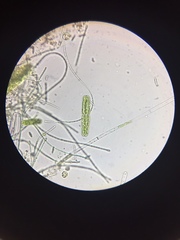 Tetmemorus brebissonii