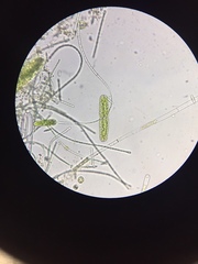 Tetmemorus brebissonii