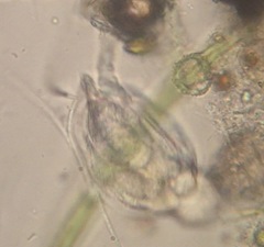 Lepadella triptera