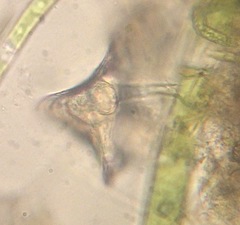 Lepadella triptera