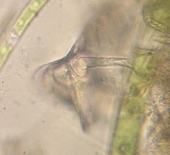 Lepadella triptera
