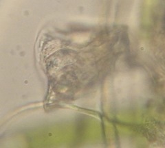 Lepadella triptera