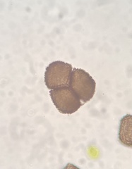 Anthoceros agrestis
