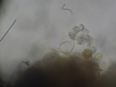 Pythium