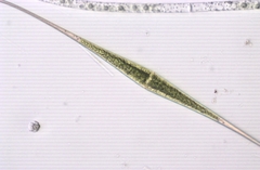 Closterium rostratum
