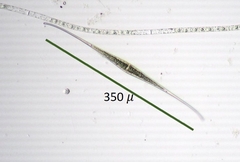 Closterium rostratum