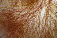 Herposiphonieae