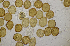 Puccinia caricina