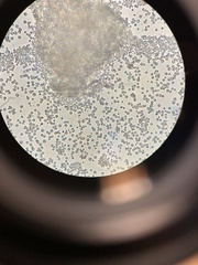 Saccharomyces cerevisiae