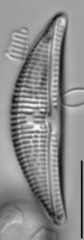 Amphora copulata