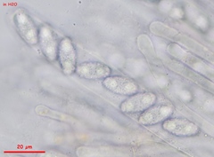 Peziza griseorosea