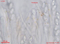 Peziza griseorosea