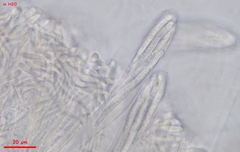 Strossmayeria basitricha