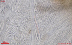 Strossmayeria basitricha