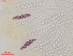 Ascobolus michaudii