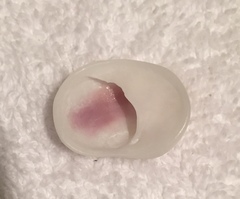 Sigapatella novaezelandiae