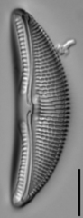 Amphora ovalis