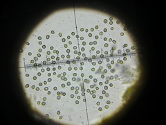 Lichenoconium xanthoriae
