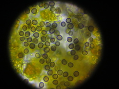Lichenoconium xanthoriae