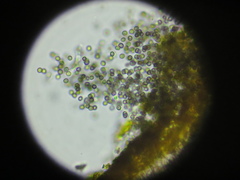 Lichenoconium xanthoriae