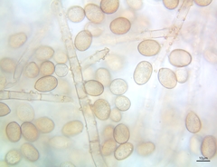 Botryobasidium conspersum