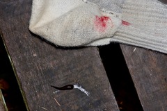 Haemadipsa zeylanica