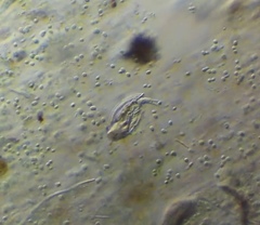 Lepadella triptera