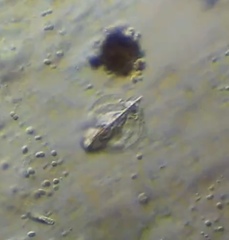 Lepadella triptera