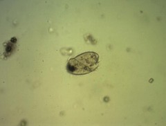 Brachonella spiralis