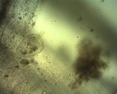 Brachonella spiralis