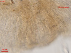 Strossmayeria basitricha