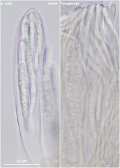 Strossmayeria basitricha